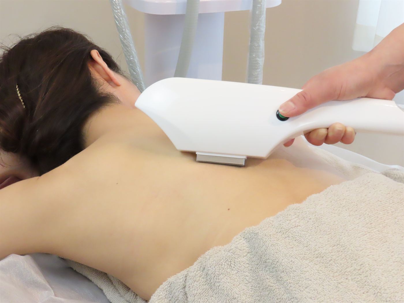 背中の脱毛施術の様子